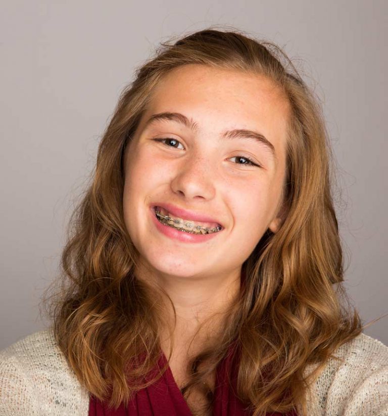 Braces for Teens | Orthodontist Ottawa ON | Centrepointe Orthodontics